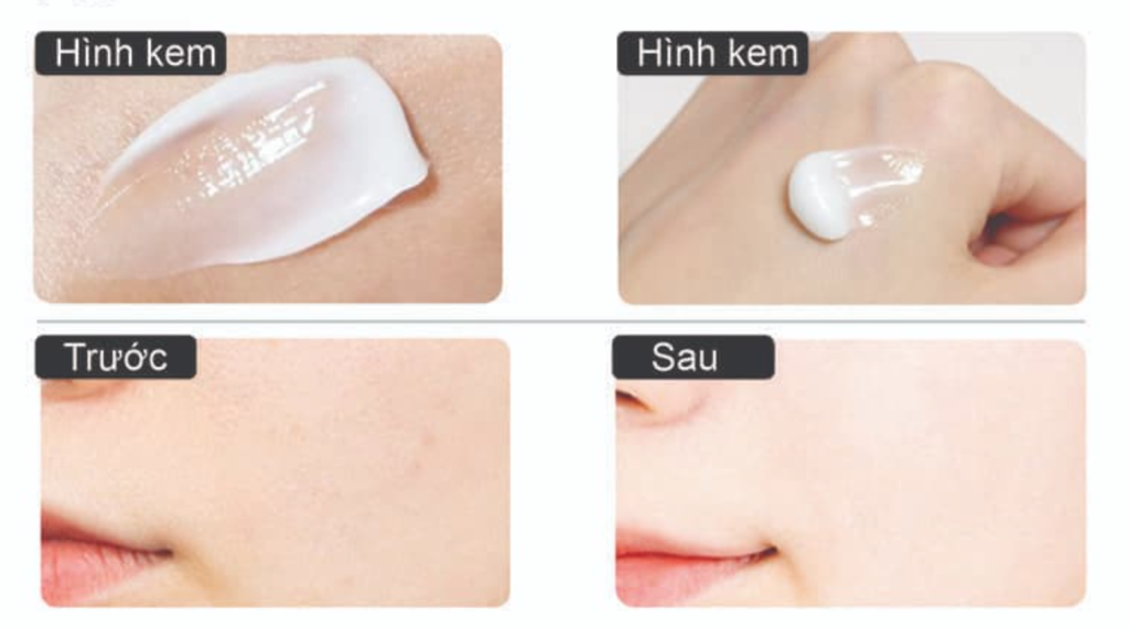 review Kem trị nám tàn nhang - TA RX Cream Wecure review Kem trị nám tàn nhang - TA RX Cream Wecure