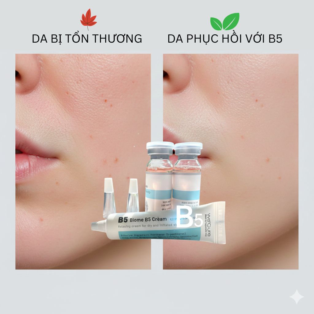 Hộp Kem dưỡng WeCure Biome B5 Skin Repair (Cream) màu trắng, chuyên biệt cho da sau điều trị.