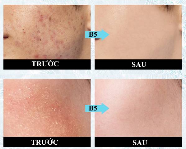 Kit phục hồi da B5 Wecure